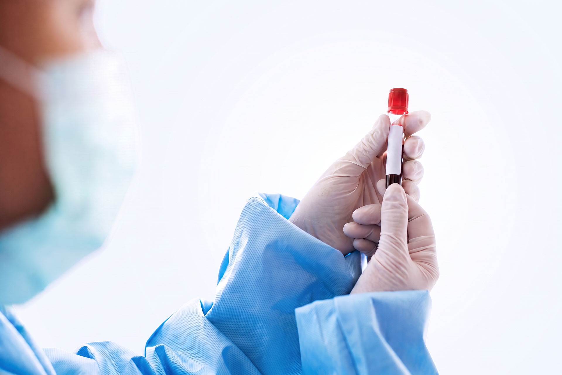 Medical professional in blue gown and gloves holding a small vial with a red cap